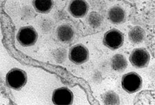 Ce virus d’amibe contrôle le noyau de son hôte à distance
