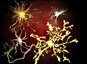 Cerveau : la RMN pour connaître les structures cellulaires