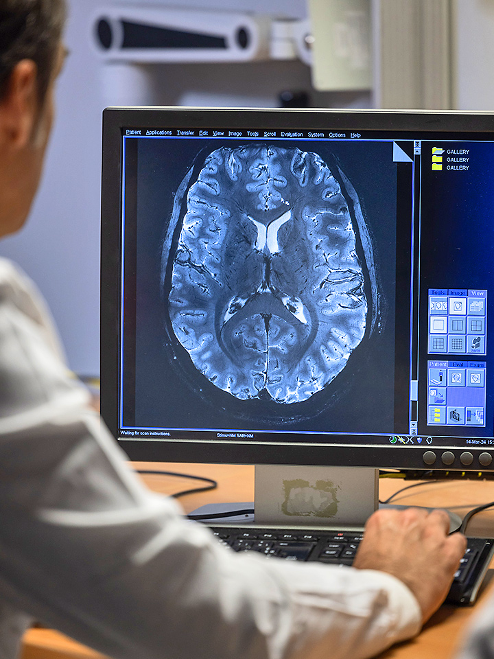 Iseult, le cerveau dévoilé dans toute sa beauté