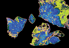 Detecting cancer 100 times faster