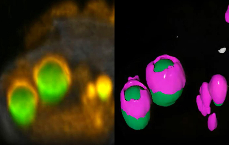 Une protéine à la double fonction optimise le stockage d’énergie cellulaire