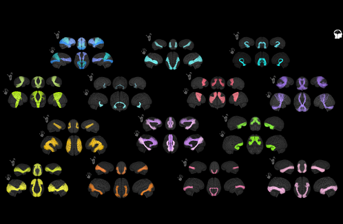 Analysis of the chimpanzee and human brain superficial structural connectivities