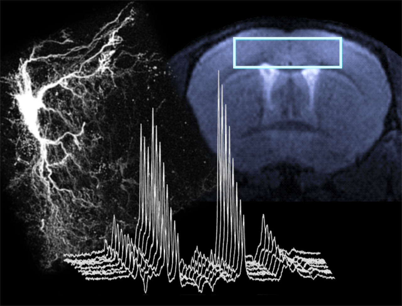 Spectroscopie RMN : Une nouvelle méthode permettant de mesurer la diffusion du lactate cérébral in vivo