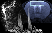Spectroscopie RMN : Une nouvelle méthode permettant de mesurer la diffusion du lactate cérébral in vivo